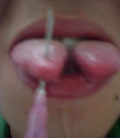 Teenage boy snake tongue process