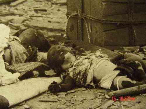 Japanese Atomic Bomb Victim