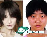 Kong Yansong before and after plastic surgery.