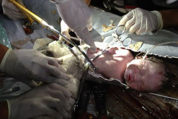 Chinese Baby Found In Toilets Sewage Drain Pipe ChinaSMACK